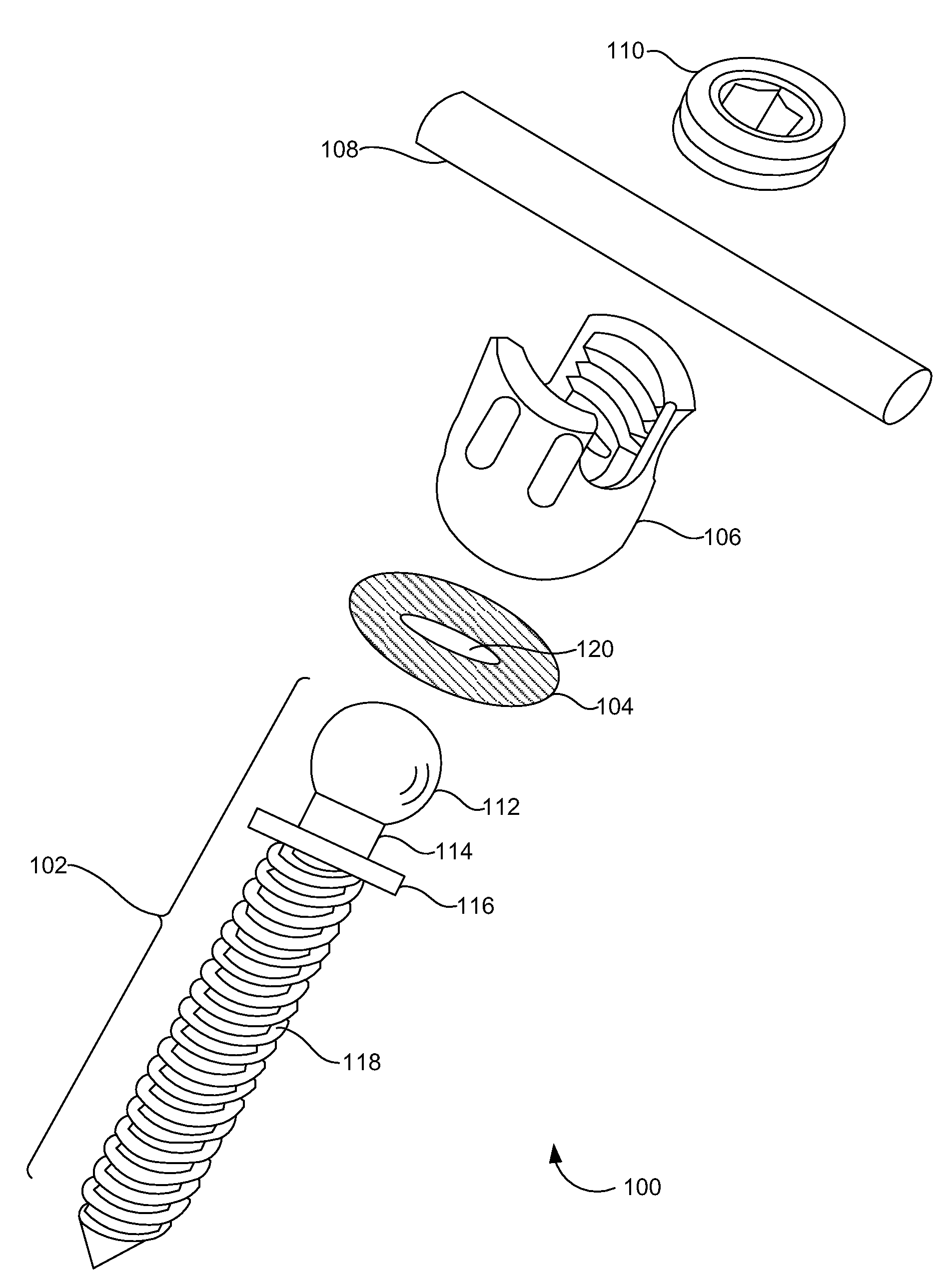 Spring-loaded dynamic pedicle screw assembly