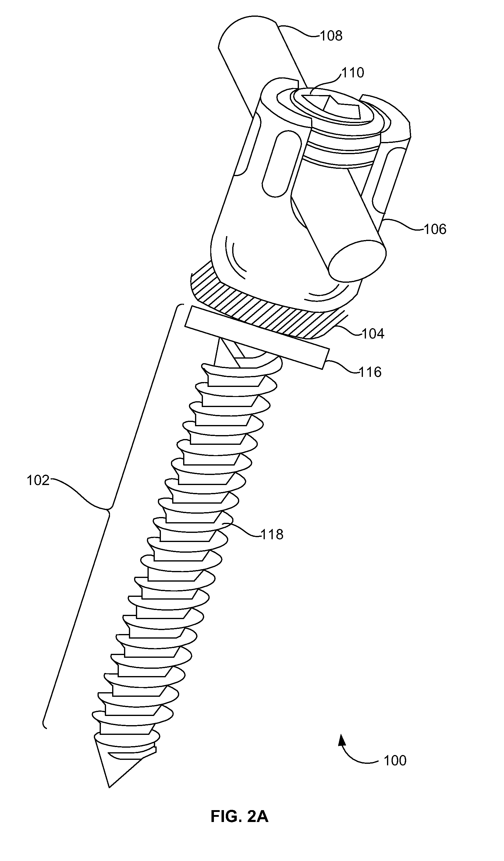 Spring-loaded dynamic pedicle screw assembly