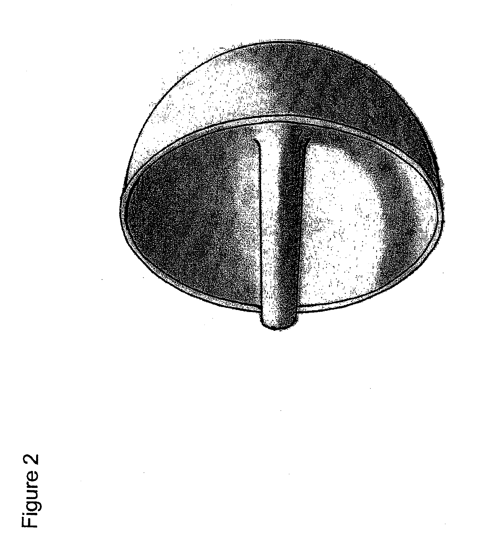 Humeral head resurfacing implant and methods of use thereof