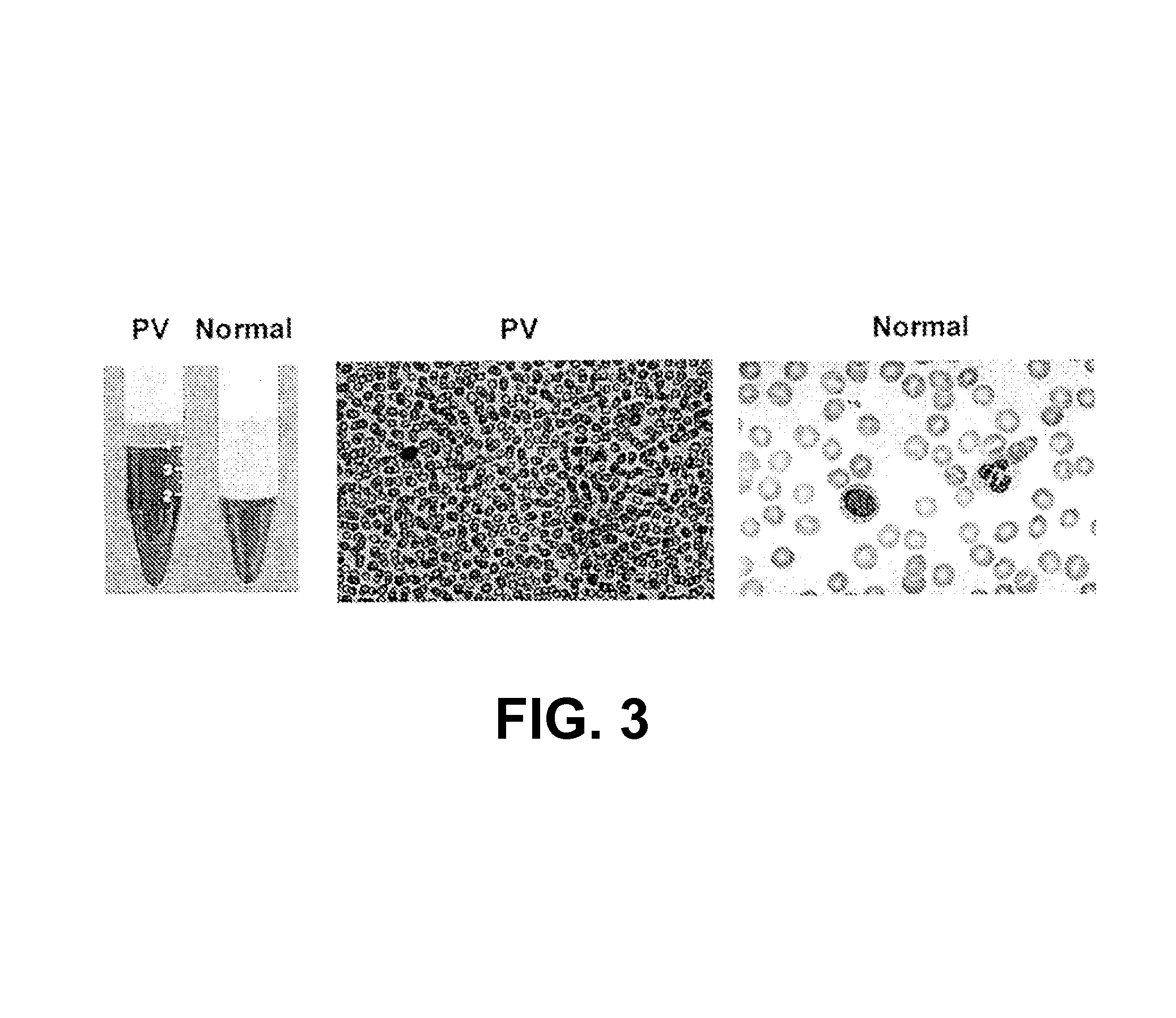 Bi-aryl meta-pyrimidine inhibitors of kinases