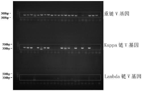 Anti-respiratory syncytial virus fully human broad-spectrum neutralizing antibody 4F1 and application thereof