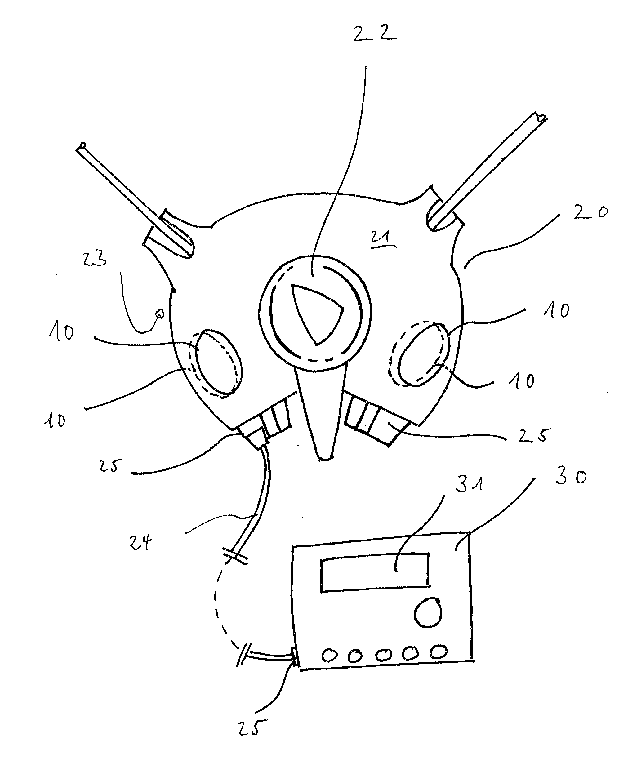 Device having electrodes for bio-impedance measurement for dialysis