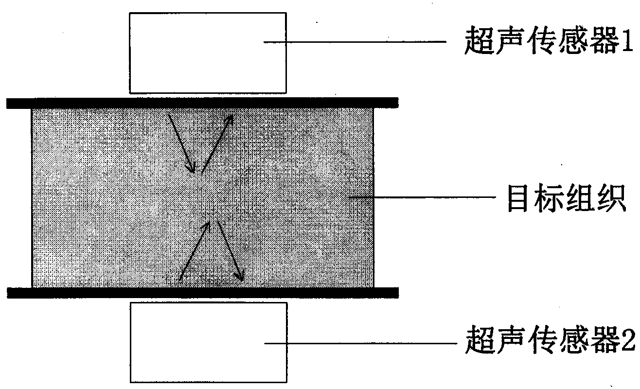 Method for improving imaging quality of limited-angle CT through combination of ultrasonic image