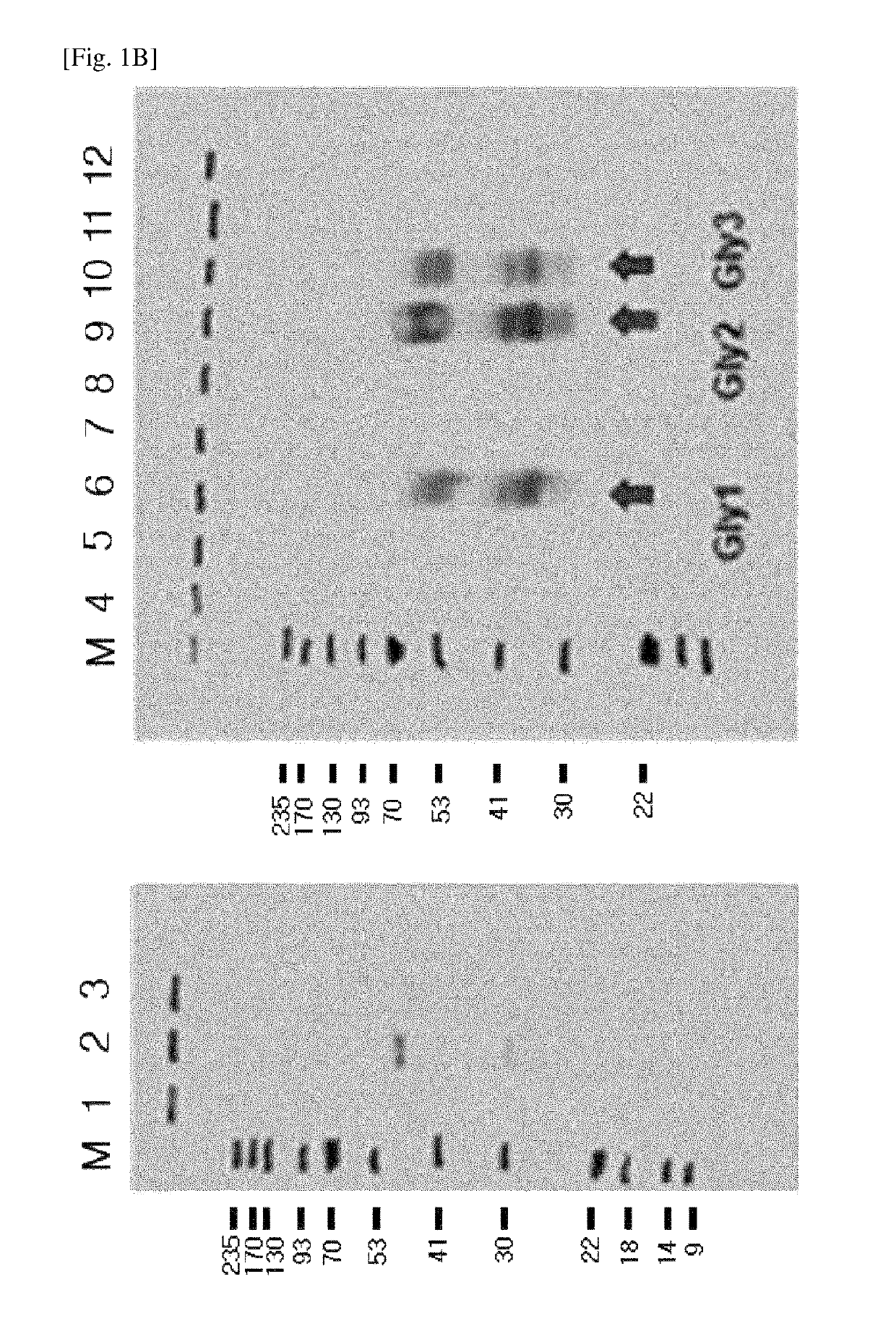 Modified DKK2 protein, nucleic acid encoding the same, preparation method thereof, and use thereof