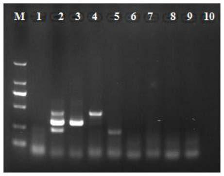 Multiplex PCR detection primer set and kit used for mycoplasma gallisepticum, mycoplasma gallisepticum and parabacterium bacillus and application of kit