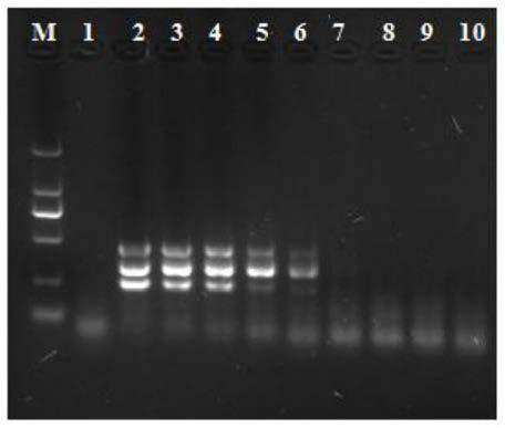 Multiplex PCR detection primer set and kit used for mycoplasma gallisepticum, mycoplasma gallisepticum and parabacterium bacillus and application of kit