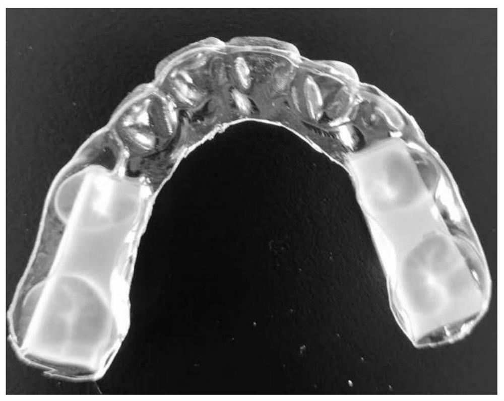 A method for preparing oral functional jaw pads by combining hot-pressed film and 3D direct printing