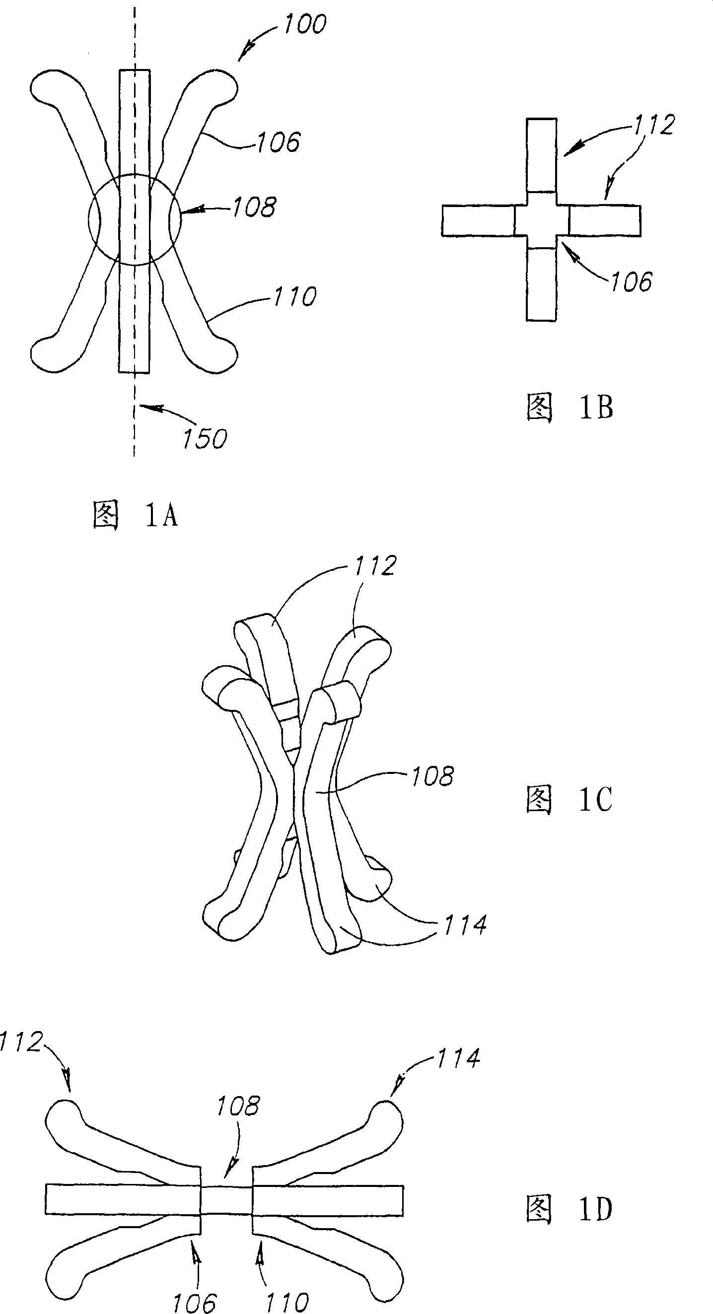 Apparatus for the prevention of urinary incontinence in females