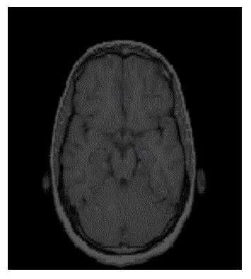 Method for encrypting medical image robust watermark based on DCT (Discrete Cosine Transform) ciphertext domain