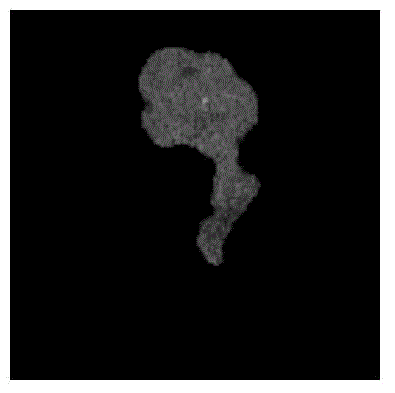 Method for encrypting medical image robust watermark based on DCT (Discrete Cosine Transform) ciphertext domain