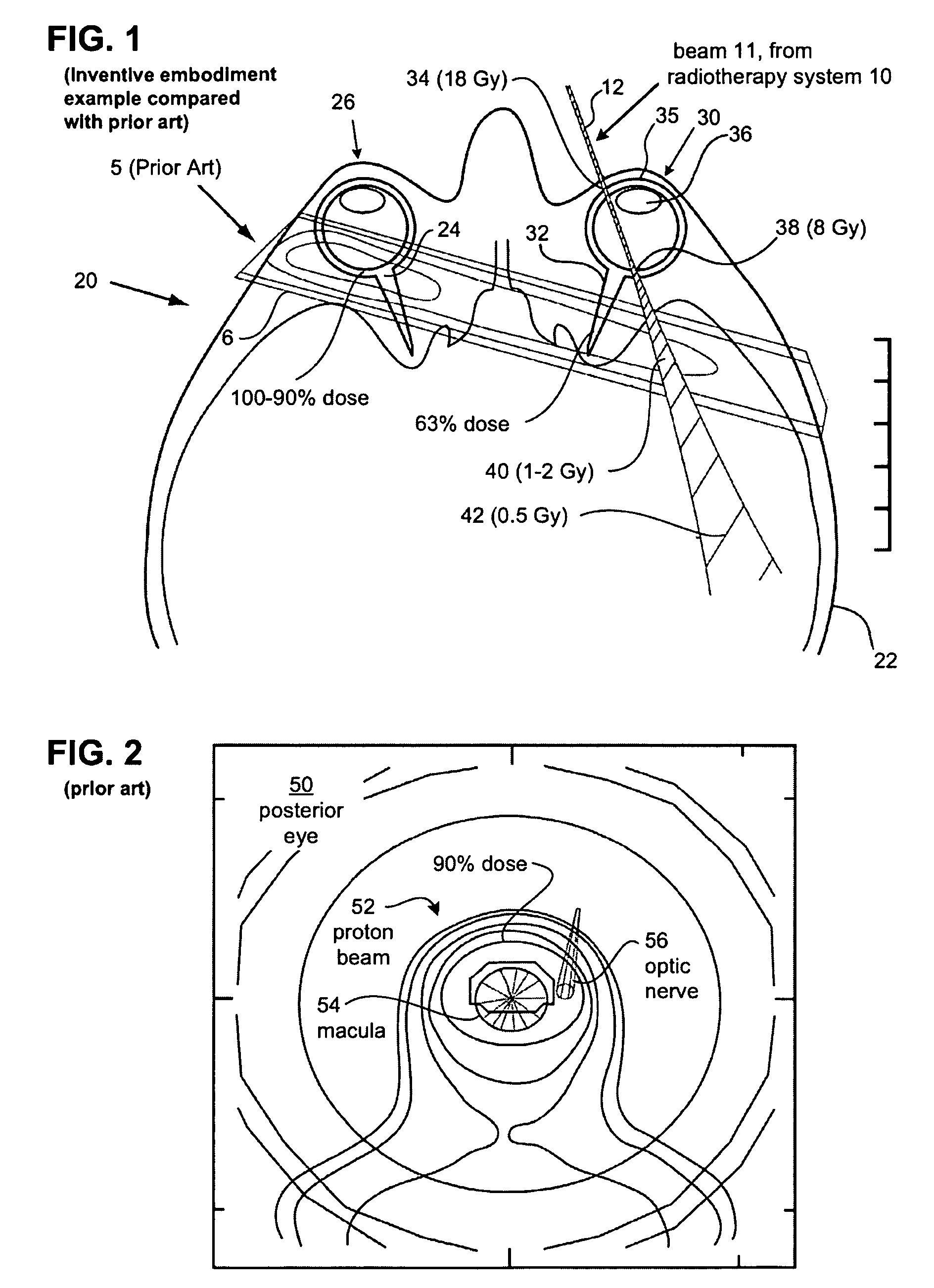 Methods and devices for orthovoltage ocular radiotherapy and treatment planning