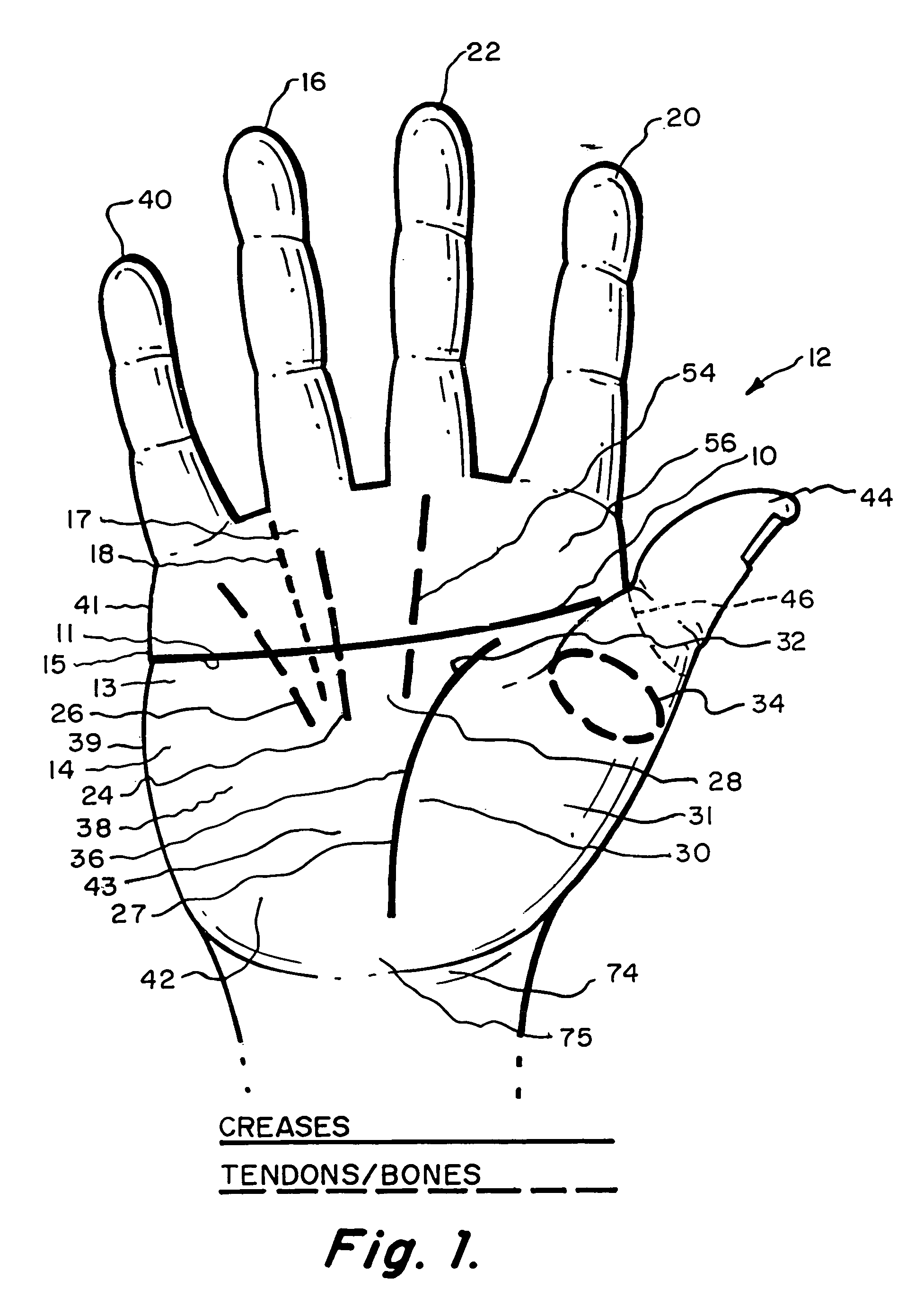 Hand accessory usable with an implement handle