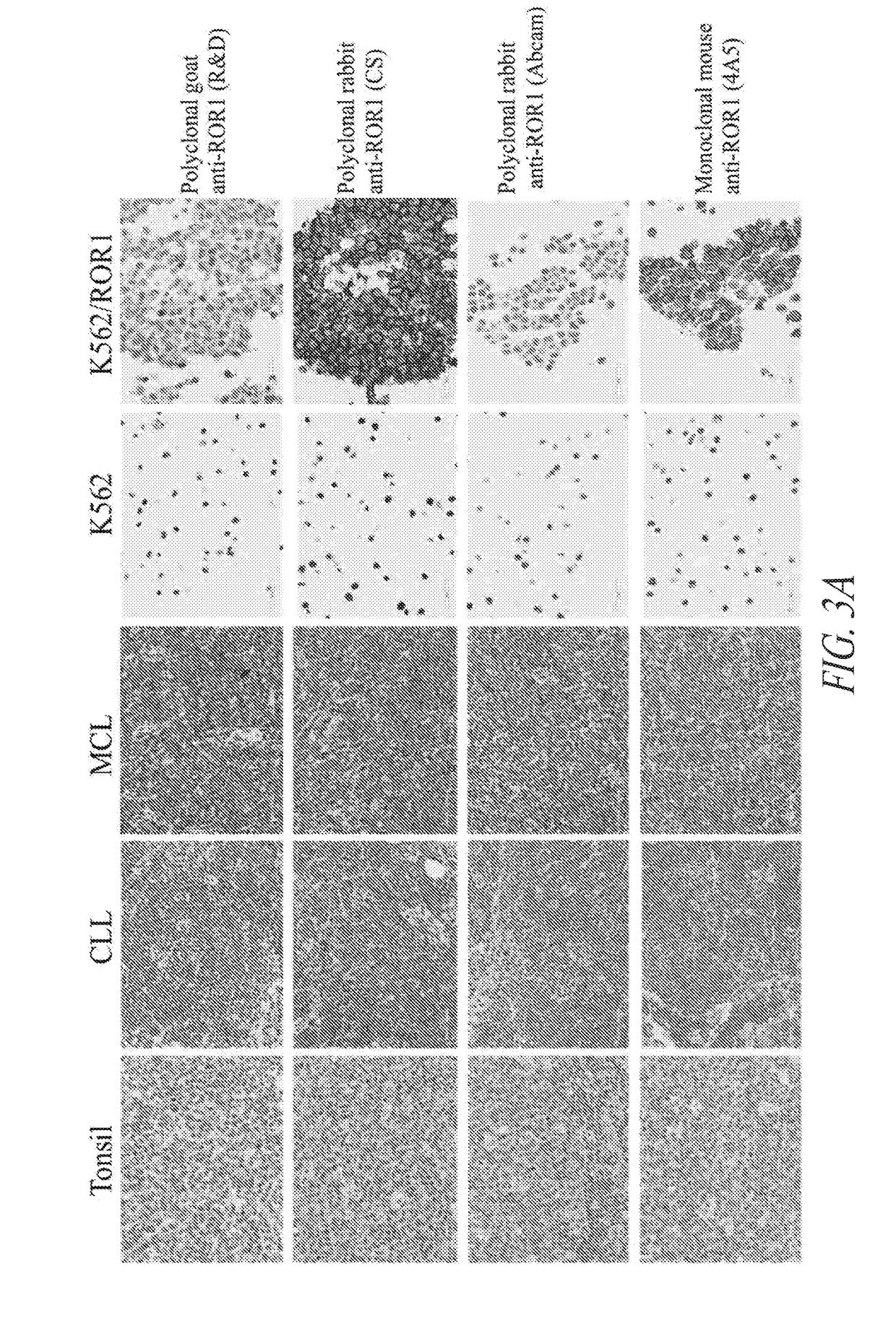 Anti-ror1 antibodies and uses thereof