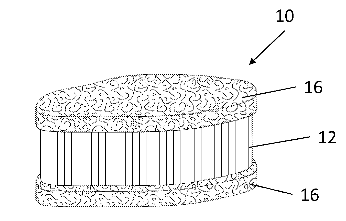 Biological Disc Graft and Method for Relief of Lower Back Pain and Joint Pain