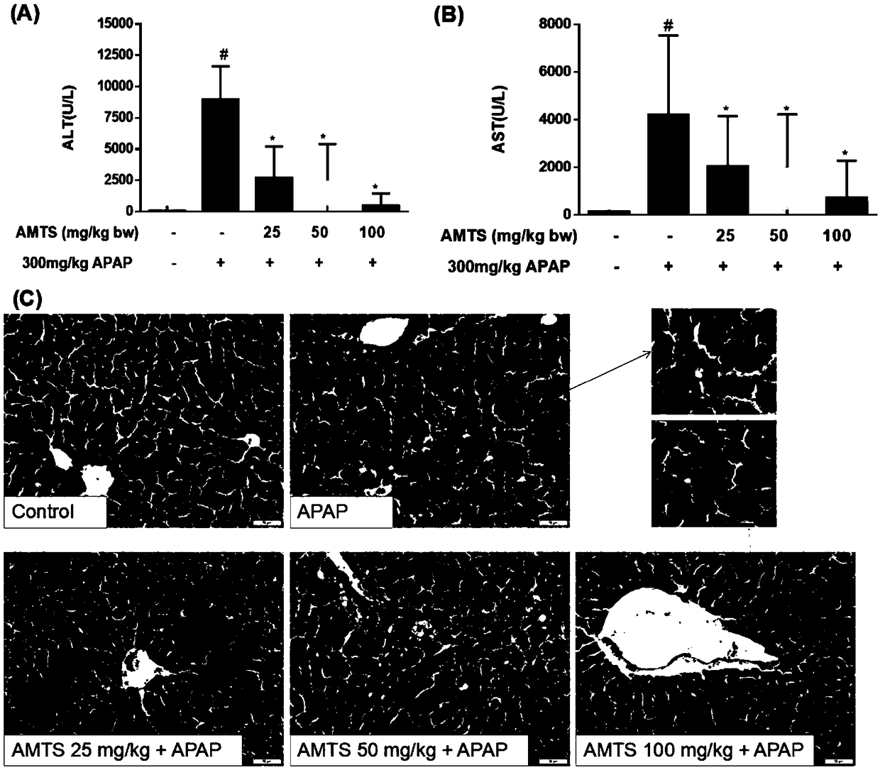 Application of allyl methyl trisulfide in preparation of product for preventing and treating drug-induced liver injury