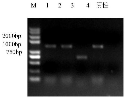 A Porcine Pseudorabies Virus Gene Deletion Attenuated Vaccine Strain and Its Application