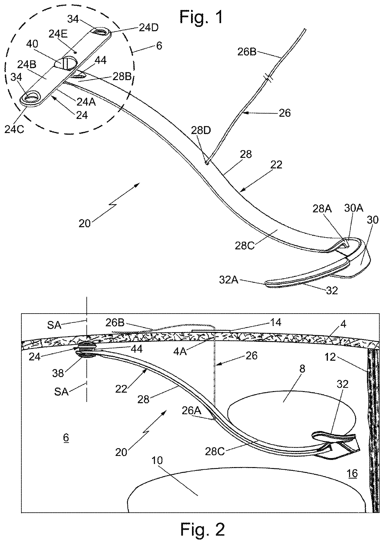 Cantilever liver retraction devices and methods of use