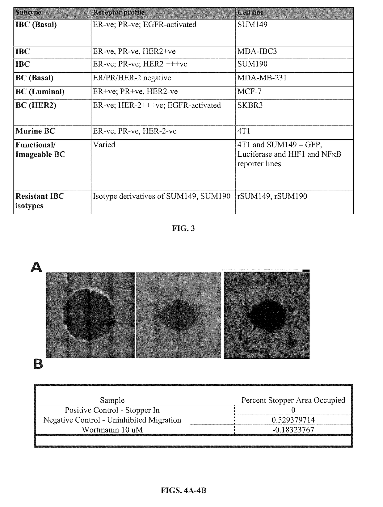 Methods for Quantitative Analysis and Targeting of Inflammatory Breast Cancer Tumor Emboli