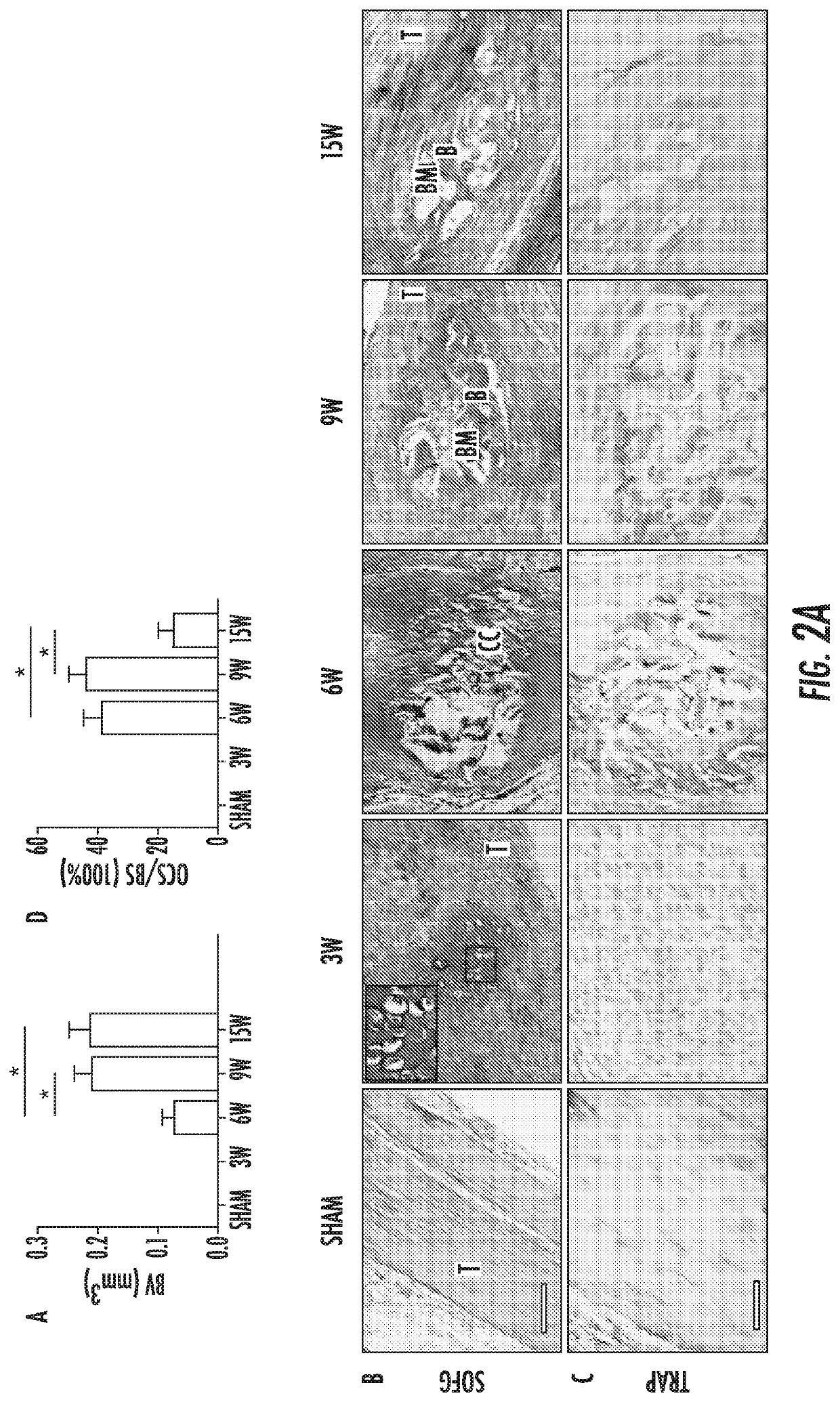 Heterotopic ossification and method of treatment