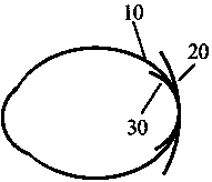 an endoscope