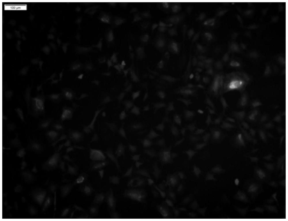 A method for stably expressing secreted human insulin in mesenchymal stem cells