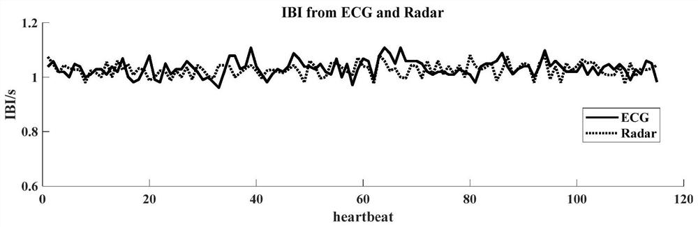 Non-contact heart rate variability monitoring method based on frequency modulated continuous wave radar