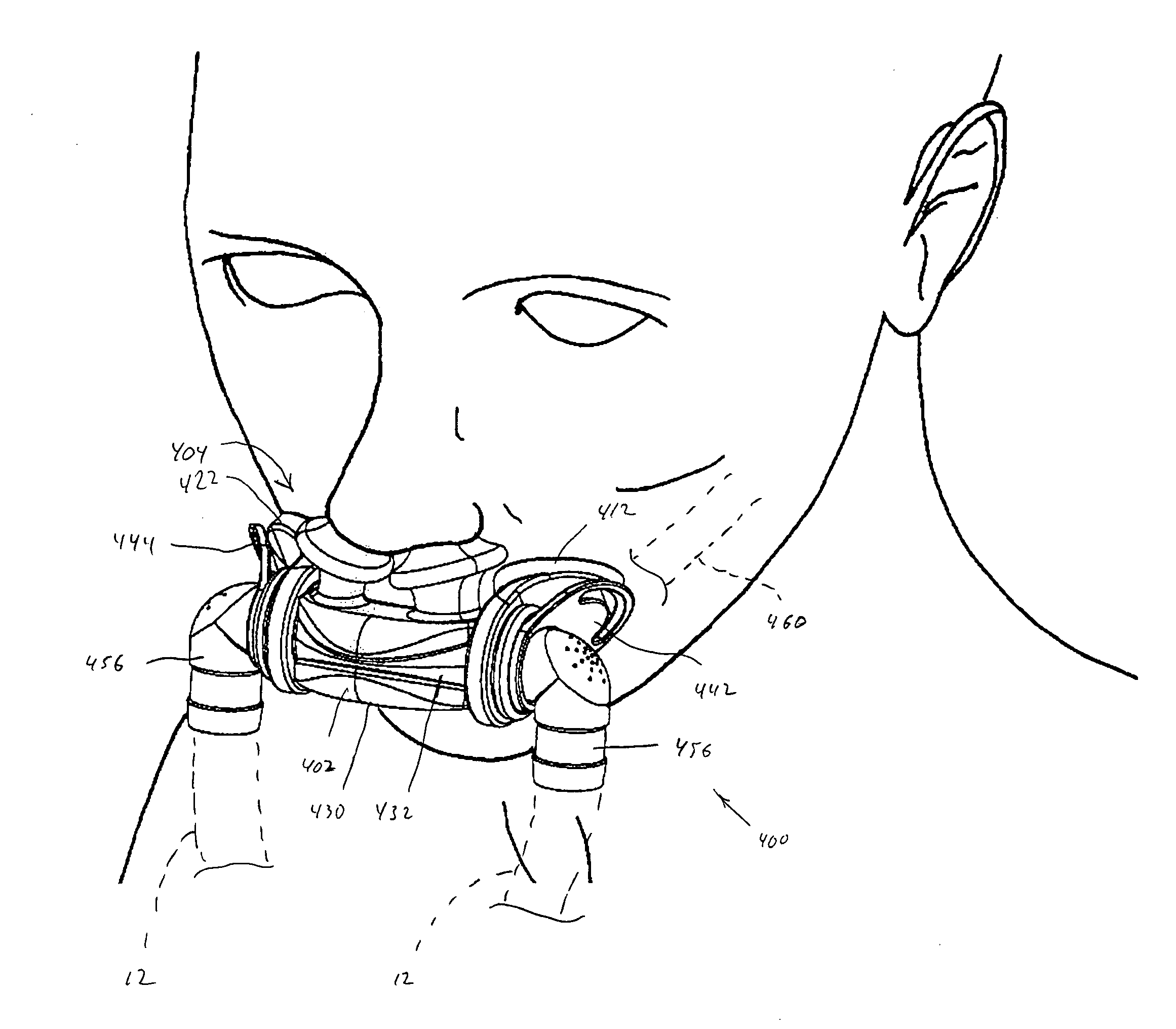 Patient interface device with limited support area on the face