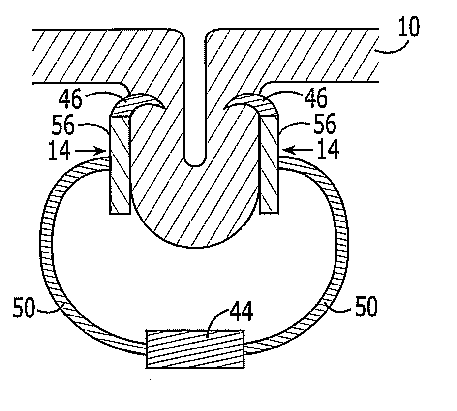 Soft Tissue Anchoring Methods and Devices