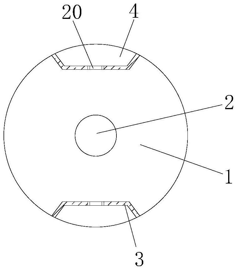 Anti-anal fissure rectum sight glass for anorectal department