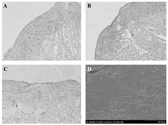 Tissue-engineered alveolar bone tissue and preparation method thereof