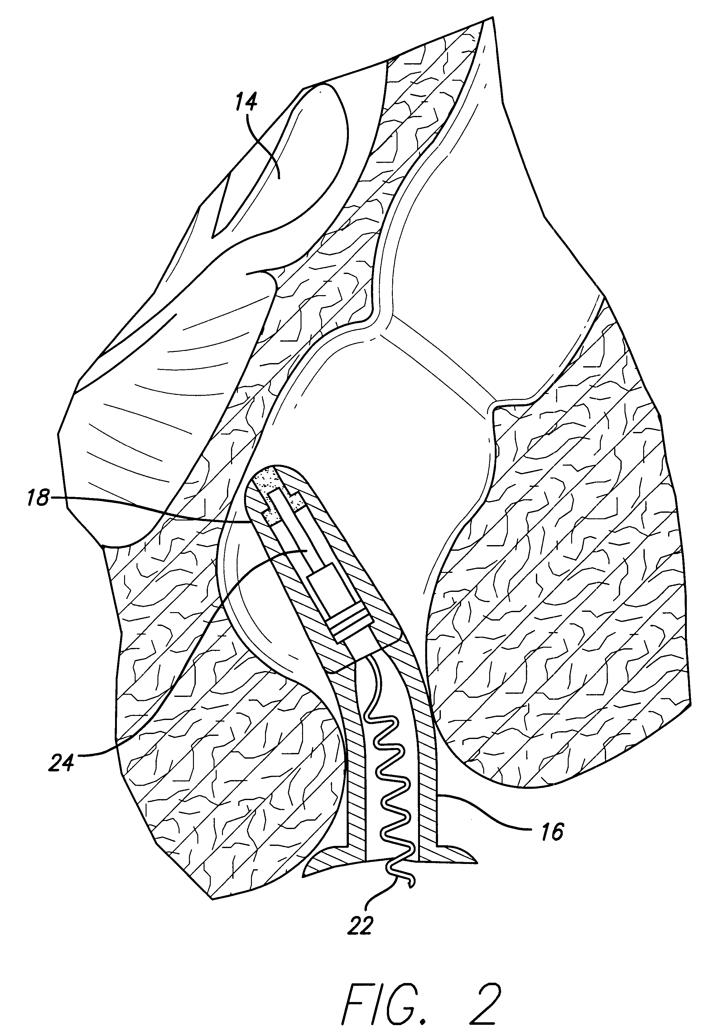 Ultrasound system for disease detection and patient treatment
