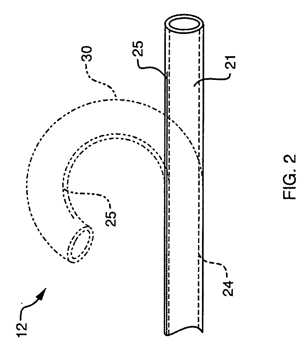 Deflectable sheath catheters with out-of-plane bent tip