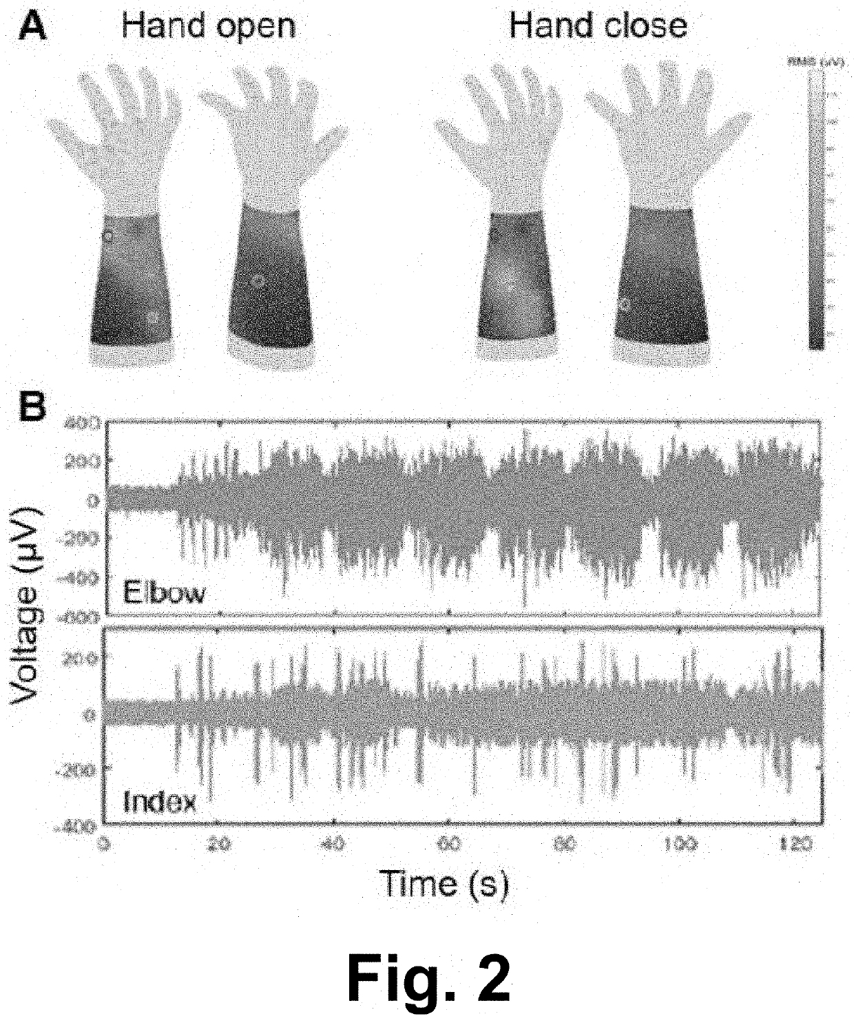 Portable and wearable hand-grasp neuro-orthosis