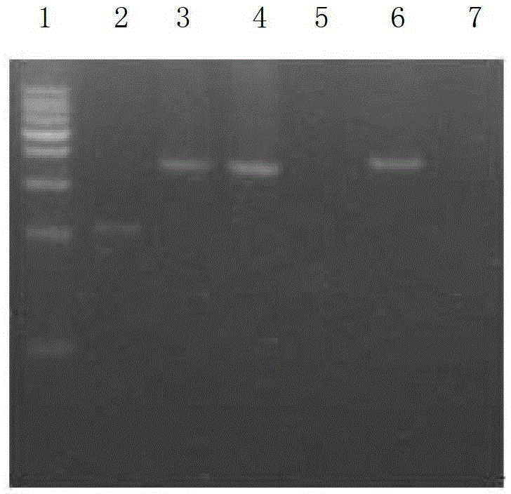 Glpks3 and its coding gene related to the synthesis of Pneumonia Kangding b0