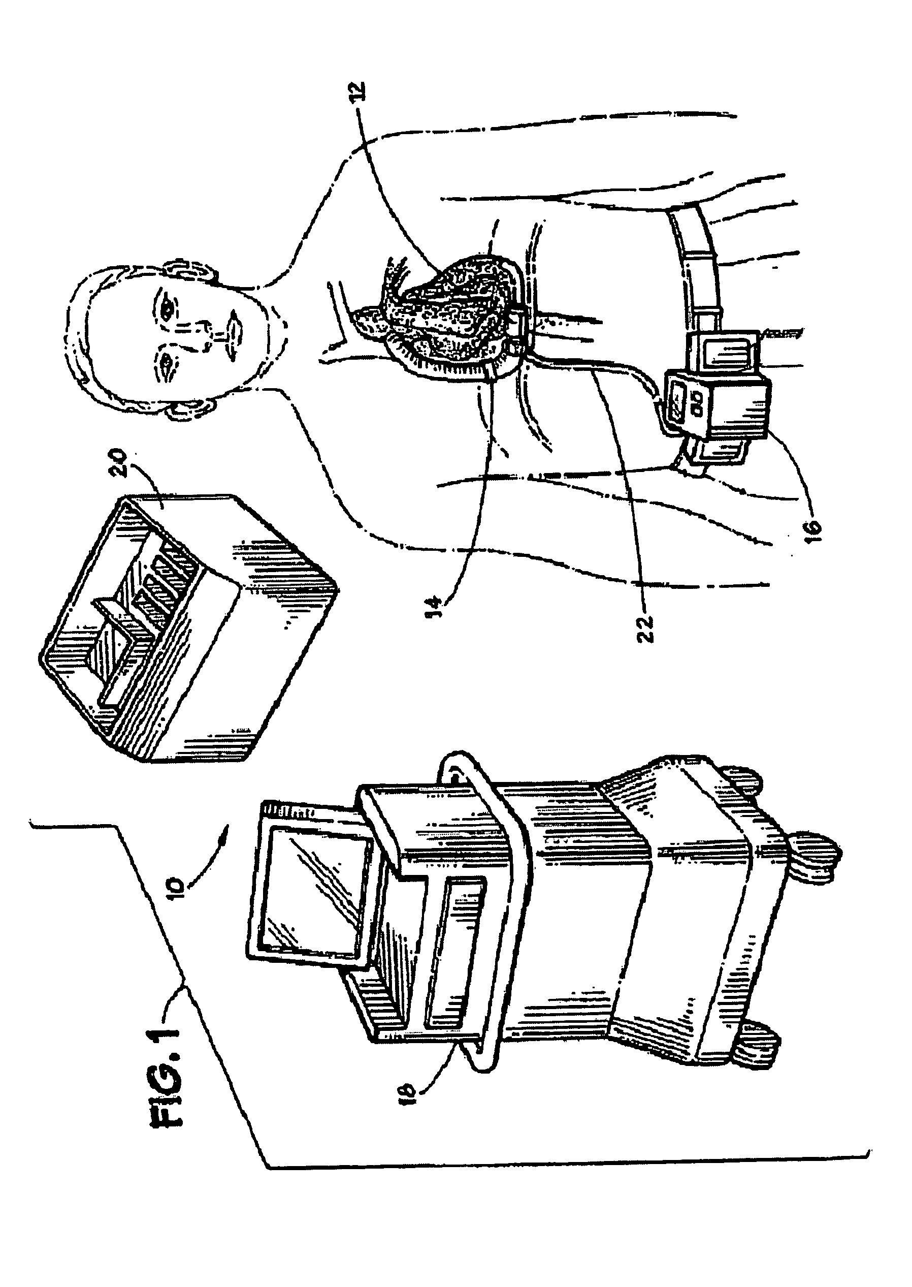 Method and system for physiologic control of a blood pump