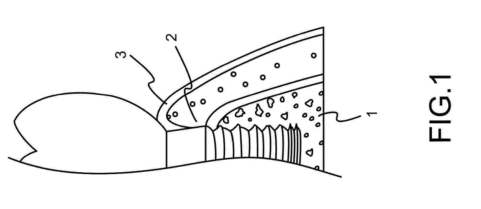 Implant Surface Treatment Method Having Tissues Integrated