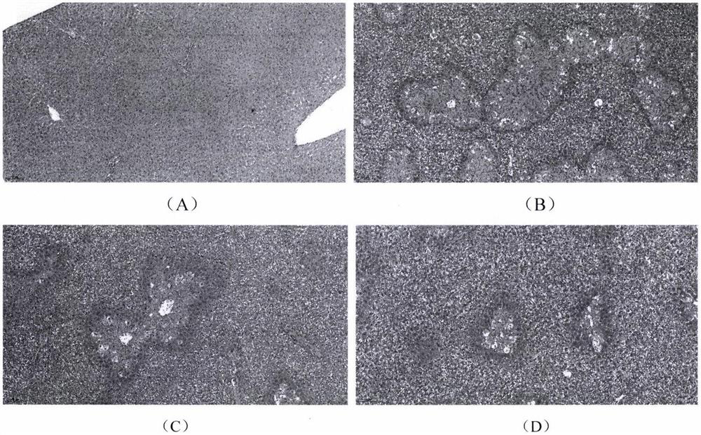 Application of cajanin in preparation of medicine for preventing and/or treating medicine-induced liver injury