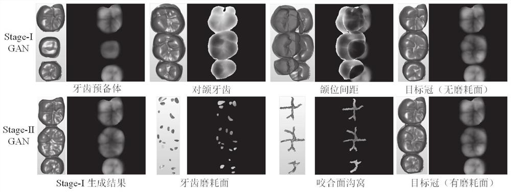 Deep generative network assisted functional full-crown restoration form generation method