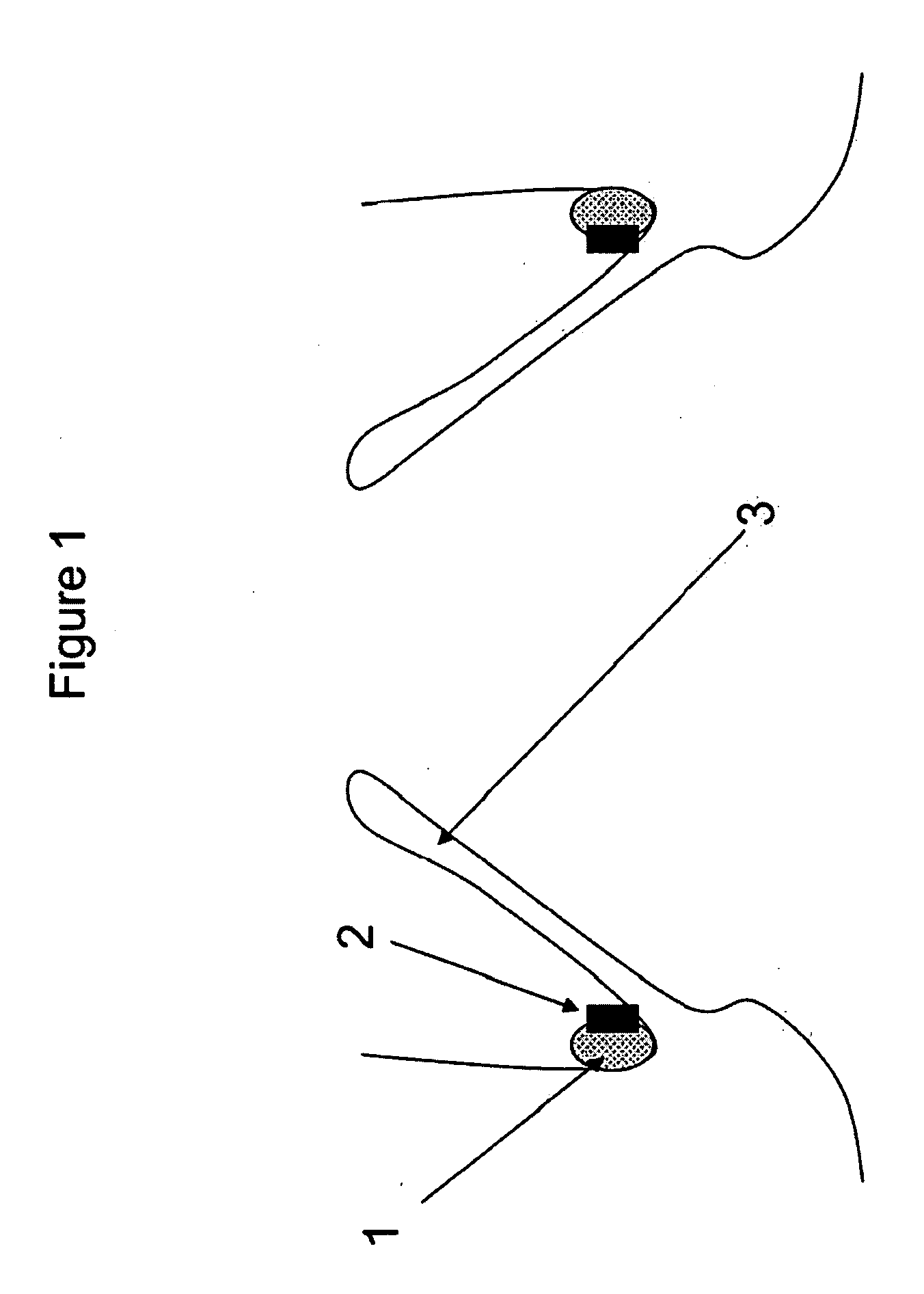 Method and apparatus for anchoring cardiovascular implants