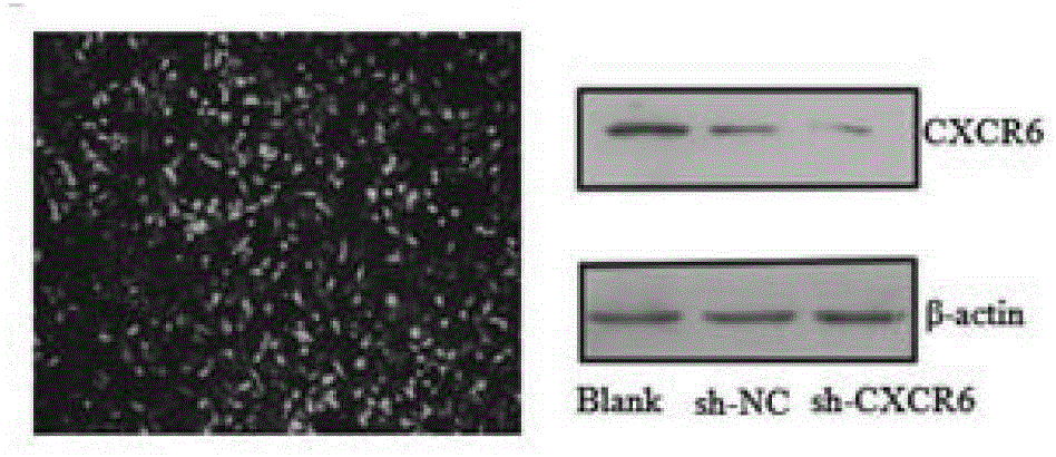 A screening kit for malignant breast cancer stem cells