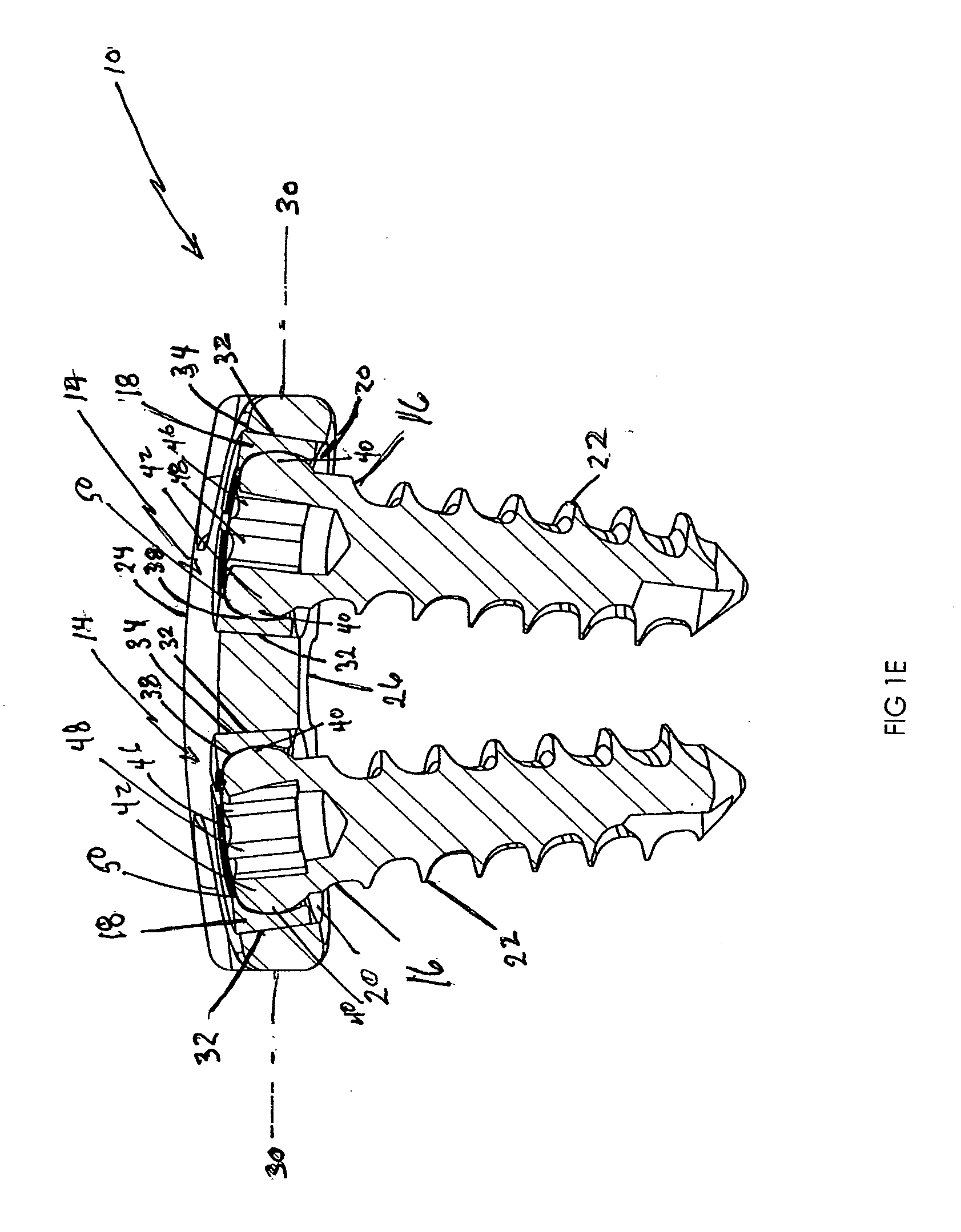 Anterior vertebral plate with taper lock screw