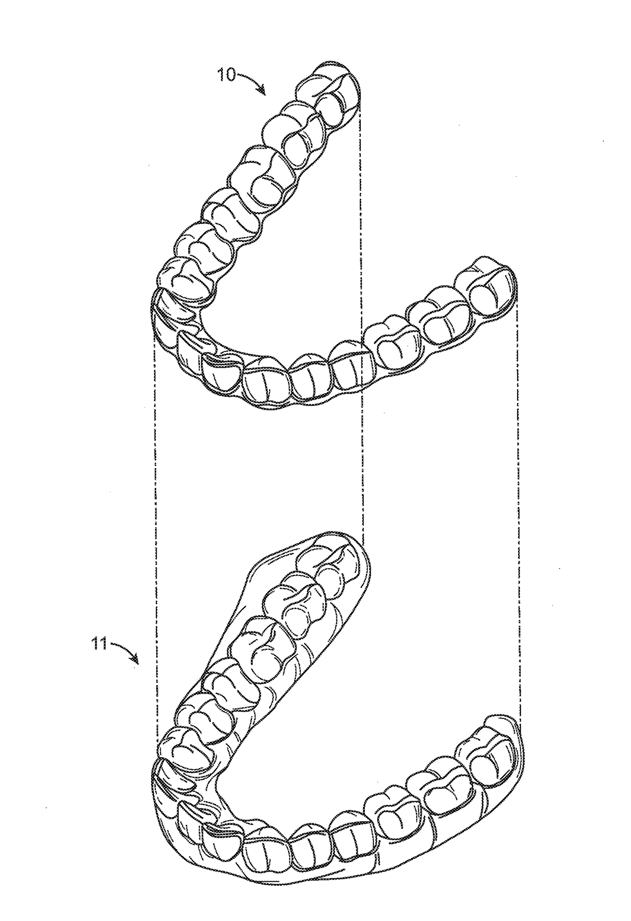 Shape engineered aligner - auto shaping