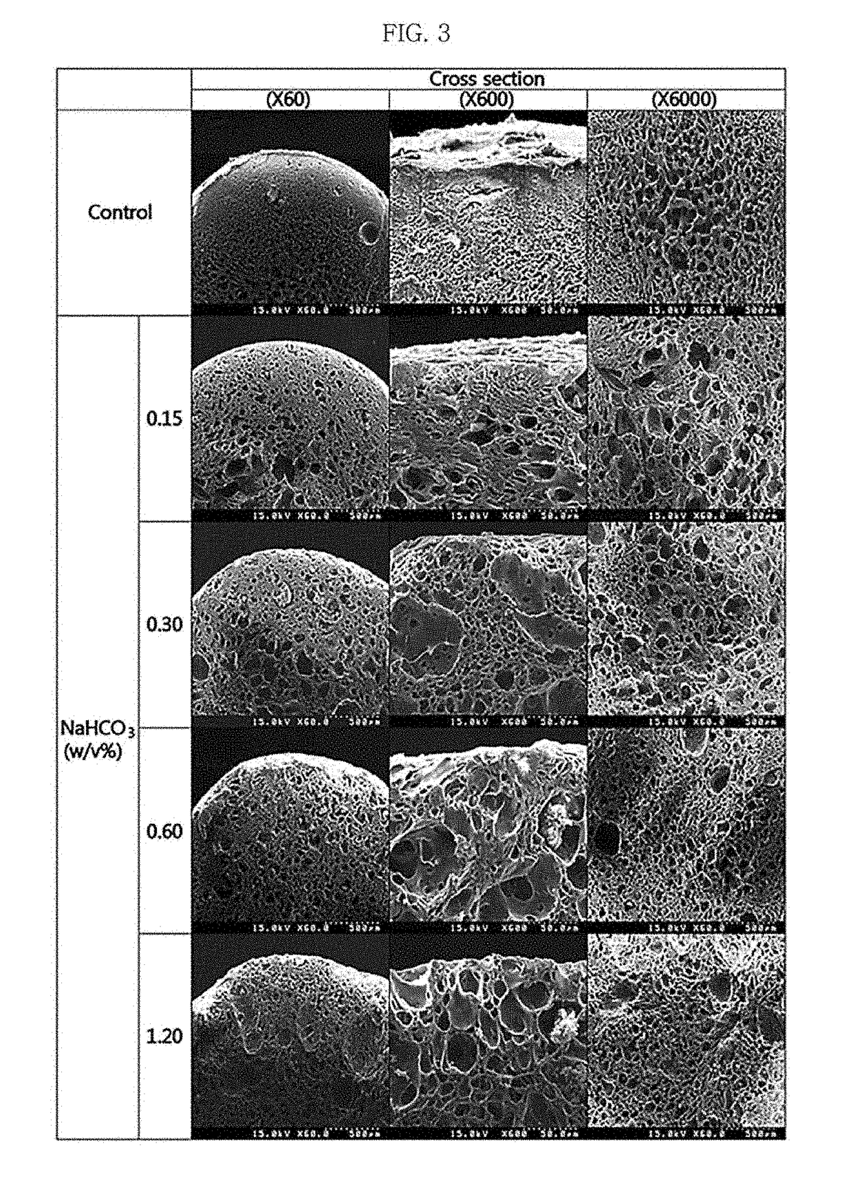 Carrier including ammonium oxidizing bacteria immobilized therein and method for preparing same