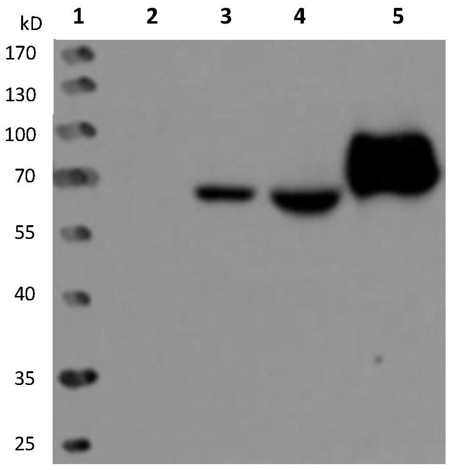 A kind of preparation method and application of CTL cells