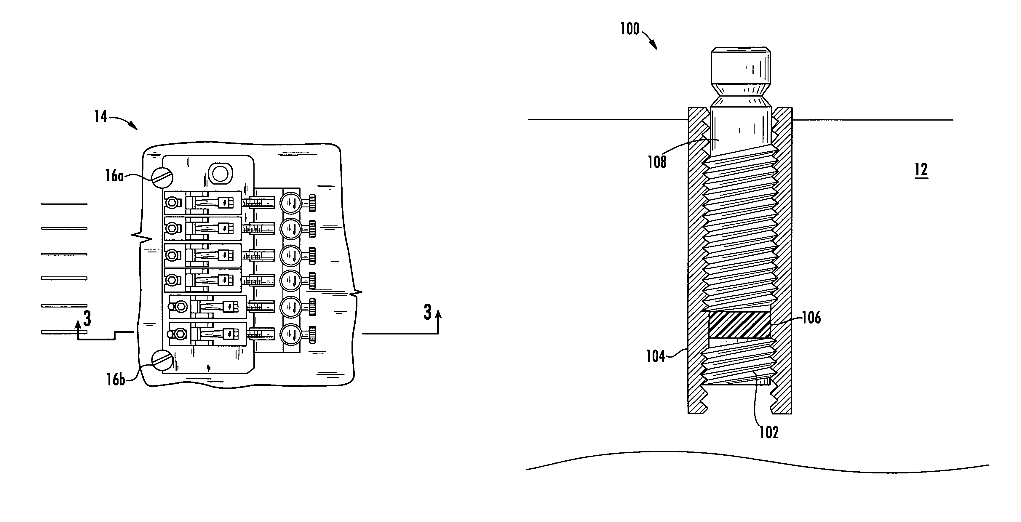 Locking post system for a guitar bridge