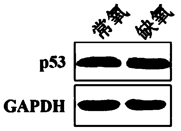 P53 protein and mitochondria double-labeled immunofluorescence detection method and kit thereof