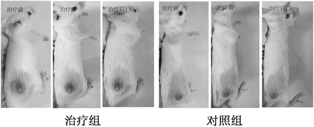 Radiofrequency treatment system