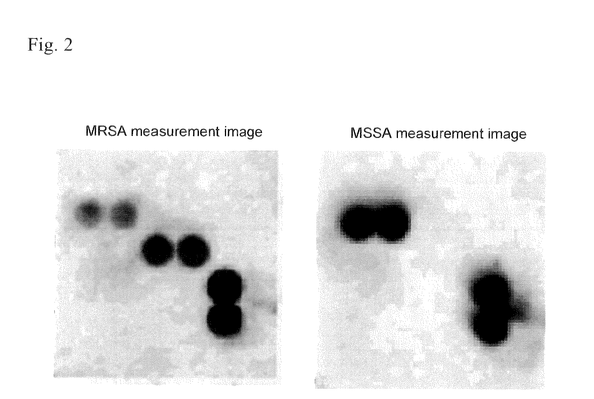 Method for extracting staphylococcus aureus antigen, reagent for extracting staphylococcus aureus antigen, and method for assessing staphyloccoccus aureus