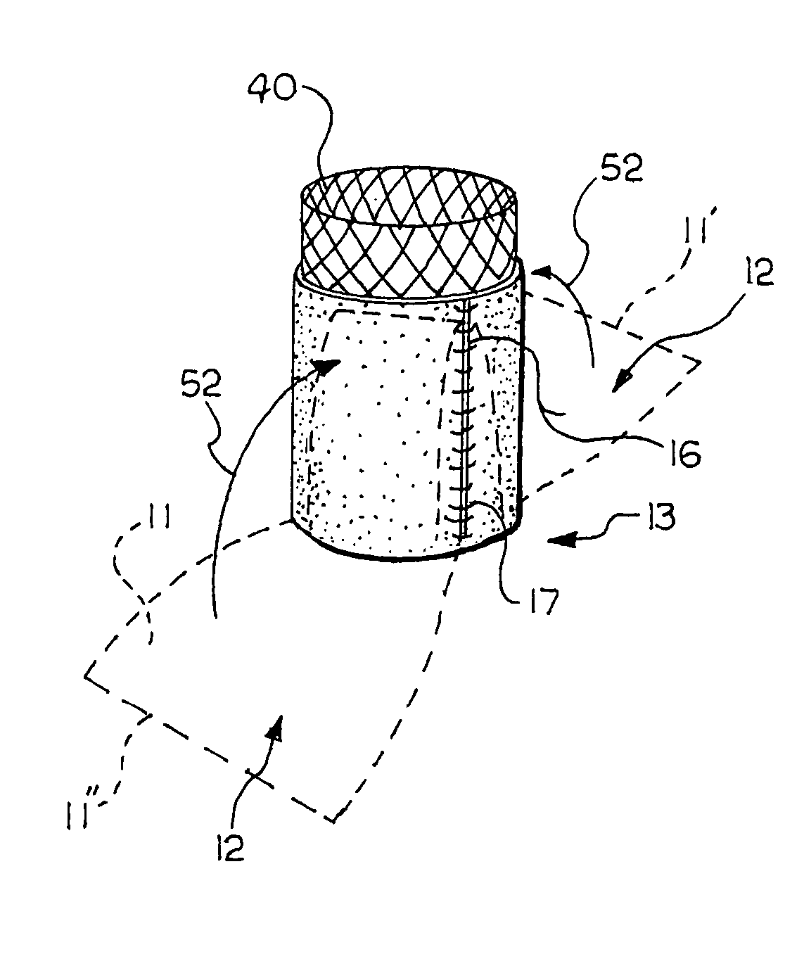 Prosthetic valve devices and methods of making such devices