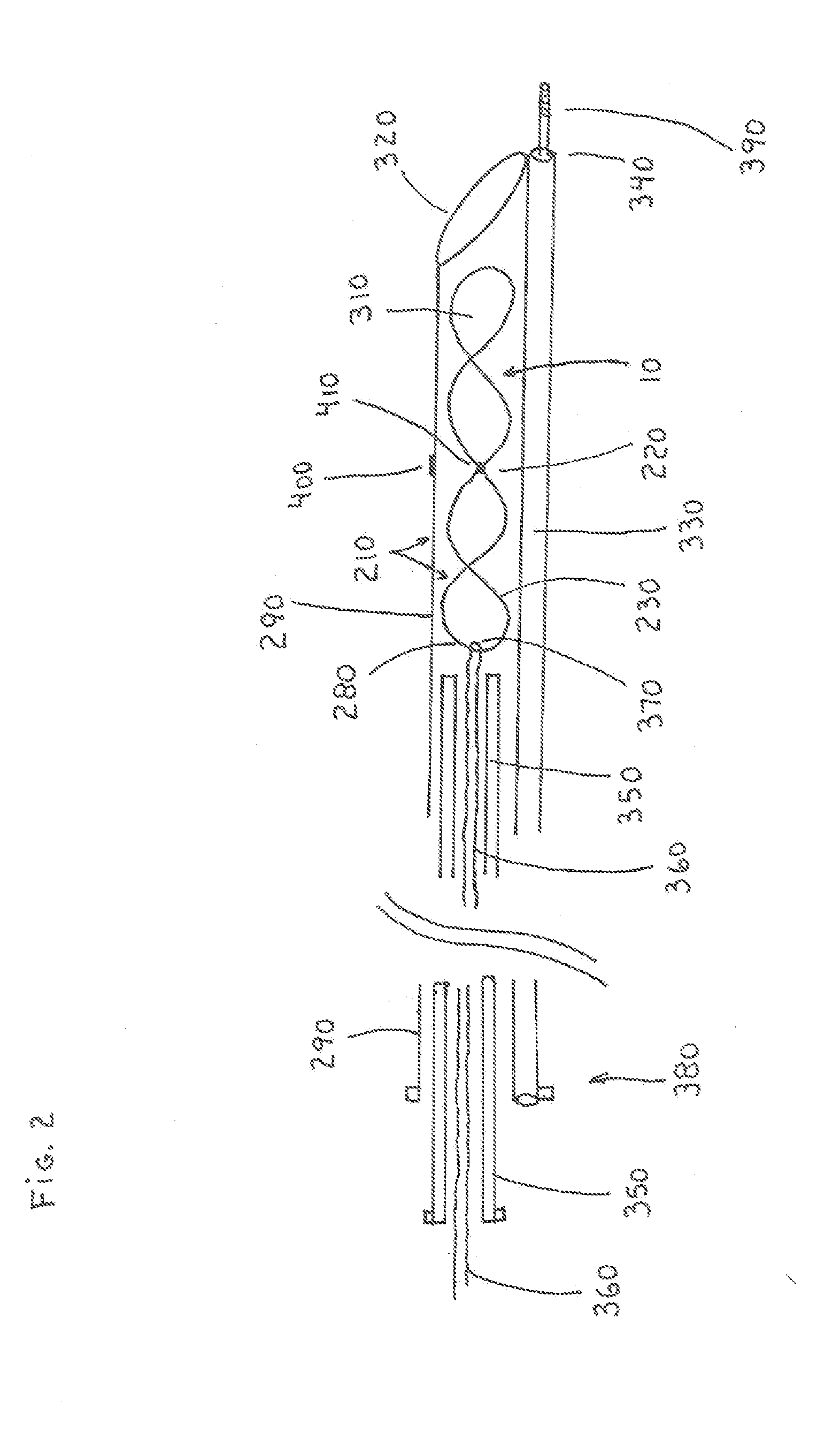 Branch and Truncal Vessel Occluder